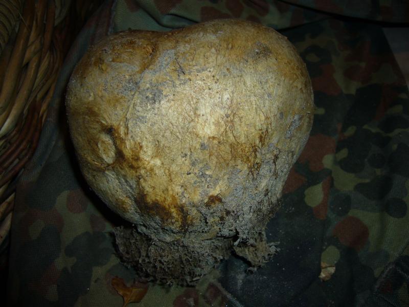 Scleroderma ?